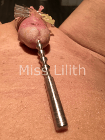 sonde urethrale et aiguilles dans le sexe
